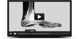 PatientEducationVideos - Aaron M. O'Brien, MD - Orthopedic Foot & Ankle Surgeon
